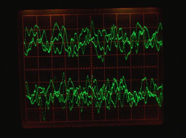 decoder